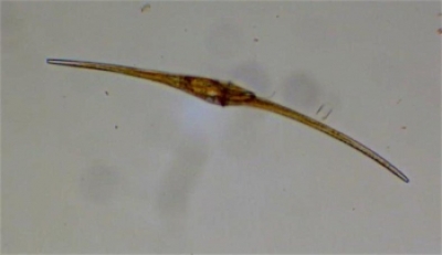 Plancton : Ceratium fusus