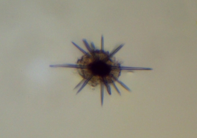 Plancton : Acanthaire